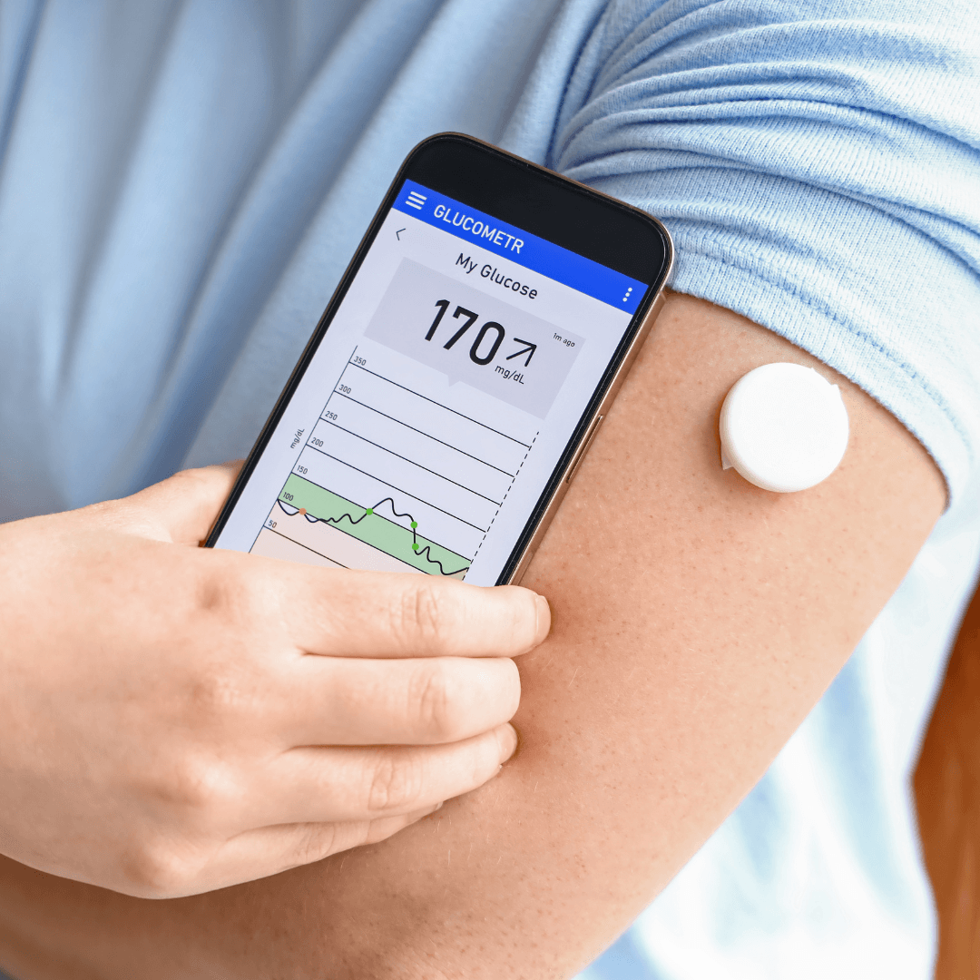 Continuous glucose monitoring to improve health in non-diabetics